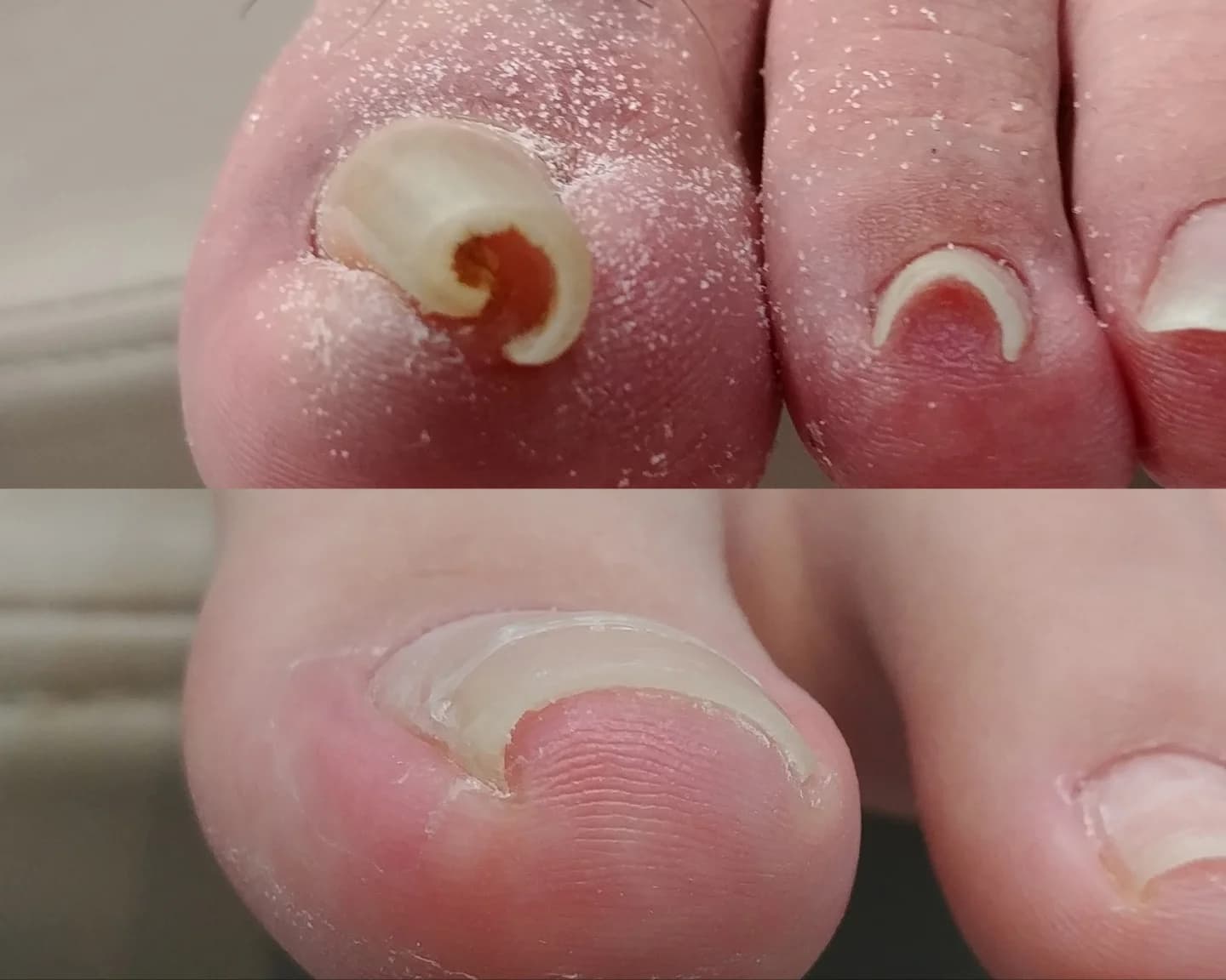 반디인하우스 발산점 발각질·문제성 발톱 관리